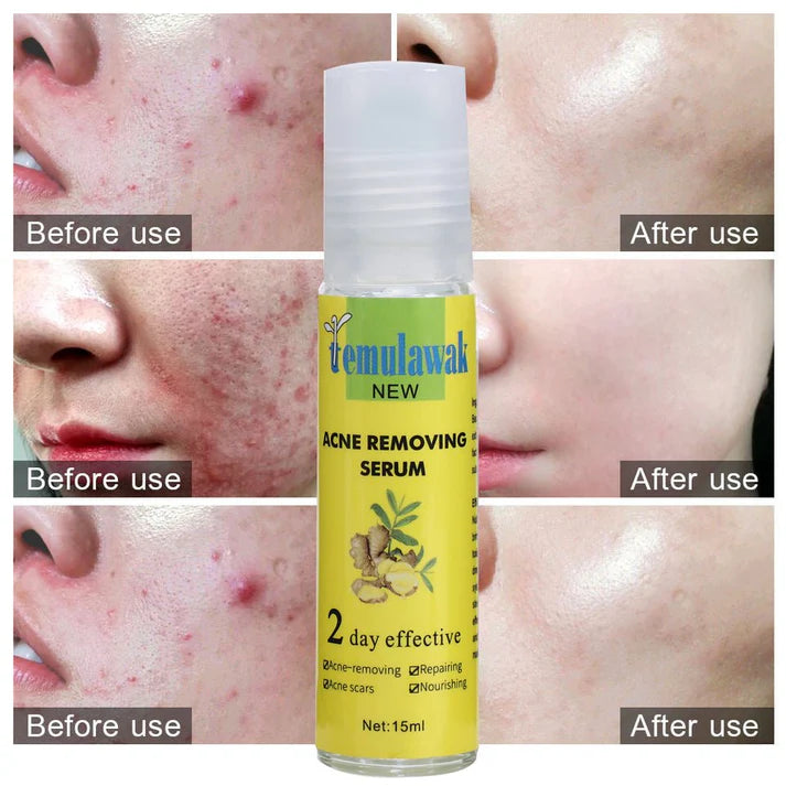 Temulawak - New Acne Removing Serum